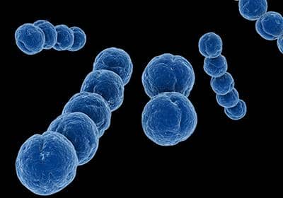 如何快速確定所表達重組蛋白的穩定性