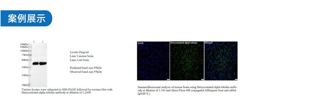 雜交瘤細胞開發-鼠單克隆抗體僅需59天