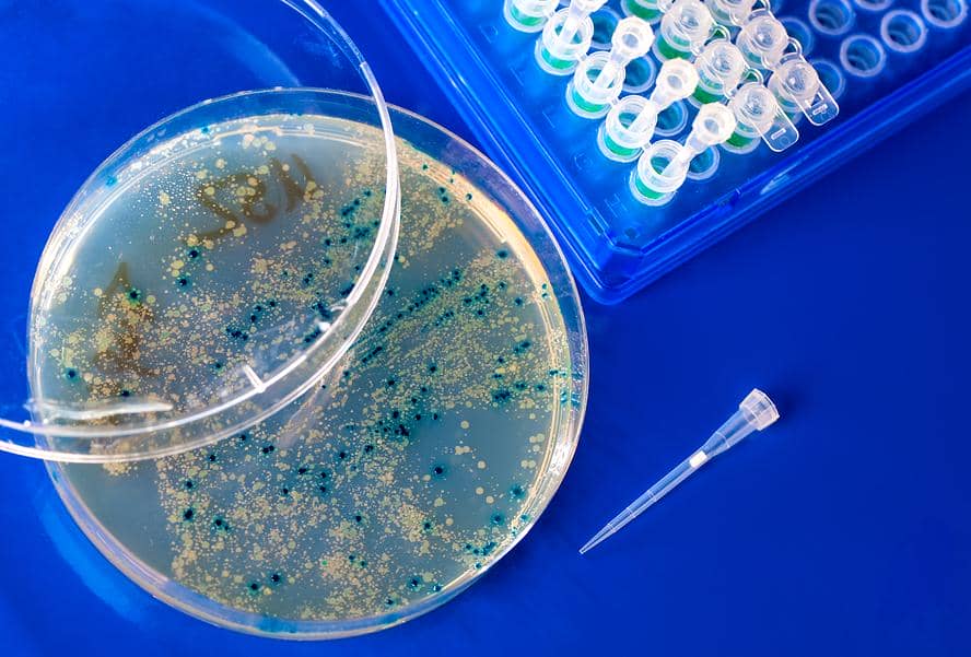 噬菌體展示文庫及噬菌體展示技術(shù)對腫瘤學(xué)的貢獻