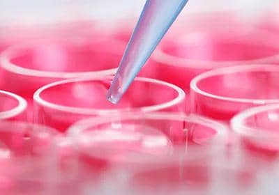 穩(wěn)定細(xì)胞株篩選各過程中的一些注意事項(xiàng)盤點(diǎn)