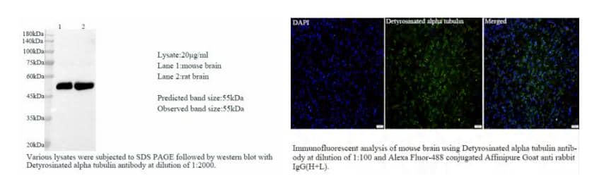 兔單克隆抗體在橫紋肌溶解相關(guān)急性腎損傷中的潛在應(yīng)用