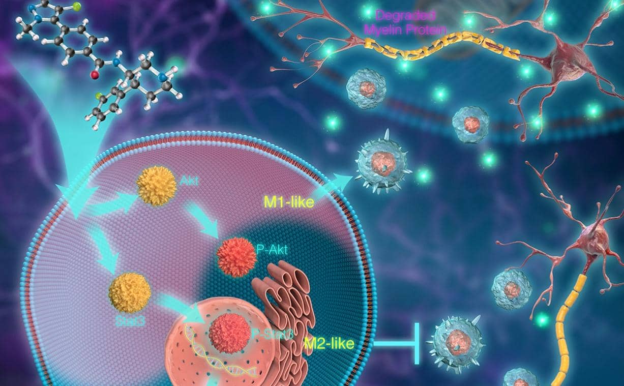 單克隆抗體在炎癥性腸病領域的臨床應用