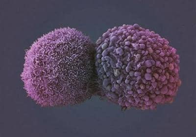 雜交瘤技術(shù)制備抗體的相關(guān)原理和詳細步驟