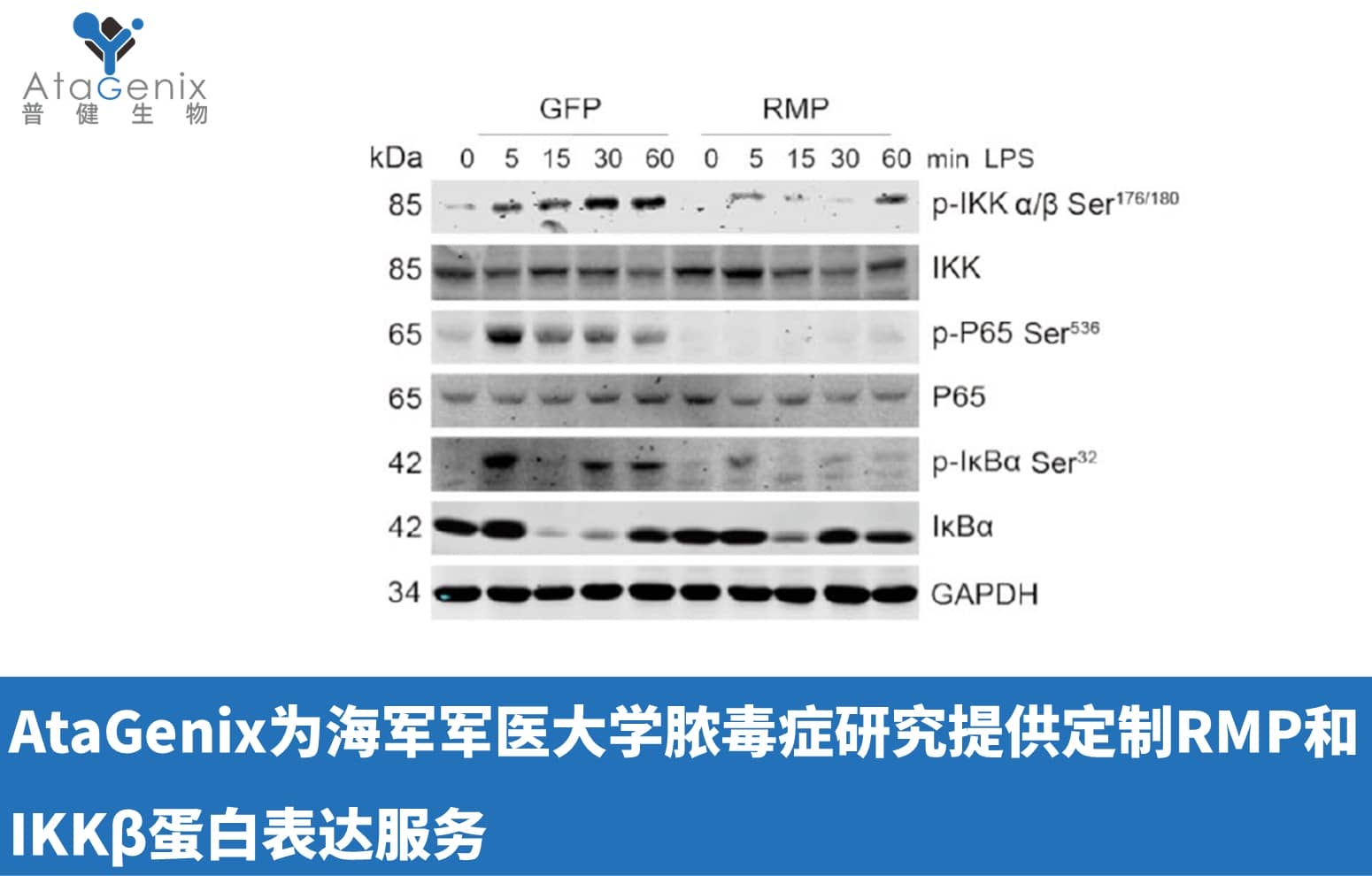 AtaGenix為海軍軍醫大學膿毒癥研究提供定制RMP和IKKβ蛋白表達服務
