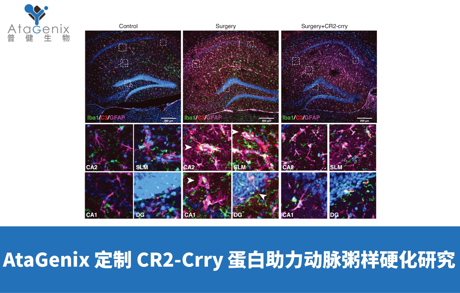 AtaGenix 定制 CR2-Crry 蛋白助力動脈粥樣硬化研究