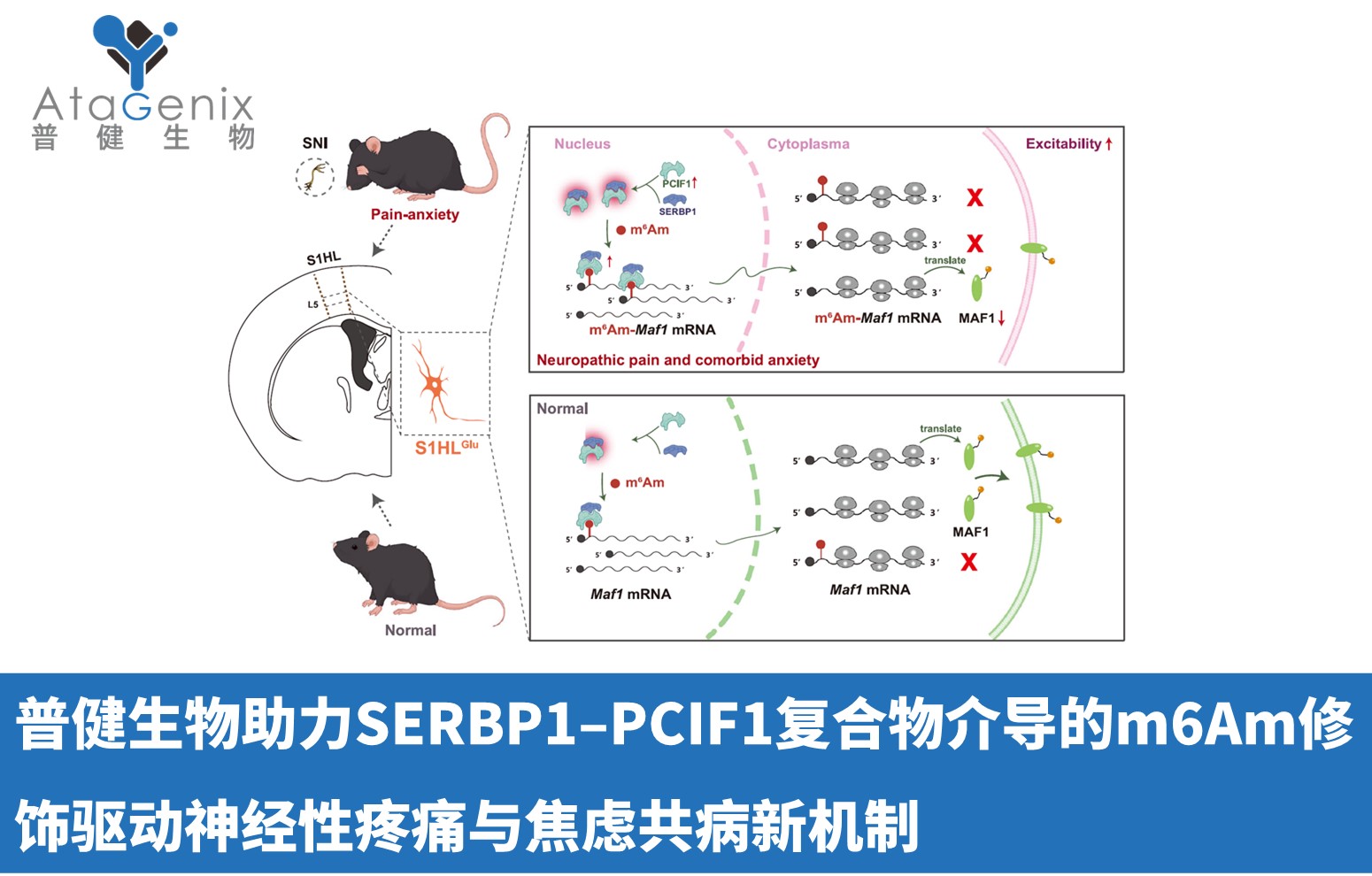 普健生物助力SERBP1–PCIF1復(fù)合物介導(dǎo)的m6Am修飾驅(qū)動(dòng)神經(jīng)性疼痛與焦慮共病新機(jī)制