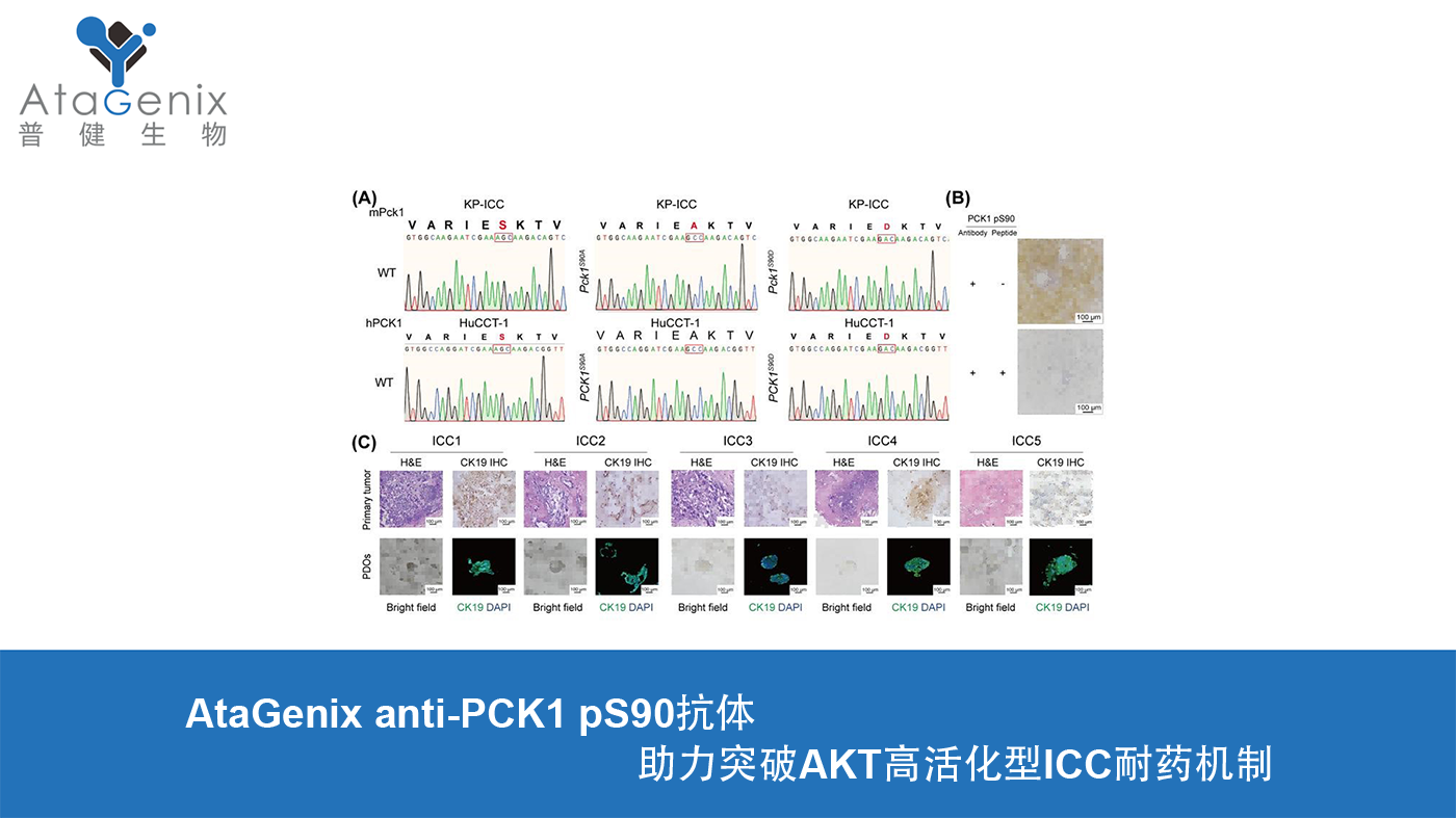 AtaGenix anti-PCK1 pS90抗體助力突破AKT高活化型ICC耐藥機制